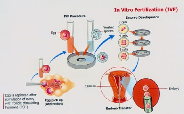 Probabilidad de embarazo con fecundación in vitro